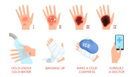 12 Injuries You NEED to Know A .